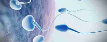 Агглютинация сперматозоидов – причина мужского бесплодия?