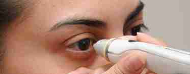 Повышенное глазное давление - лечение или приговор?