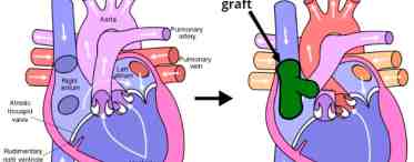 Строение сердца животного: клапанный аппарат, оболочка и круги кровообращения