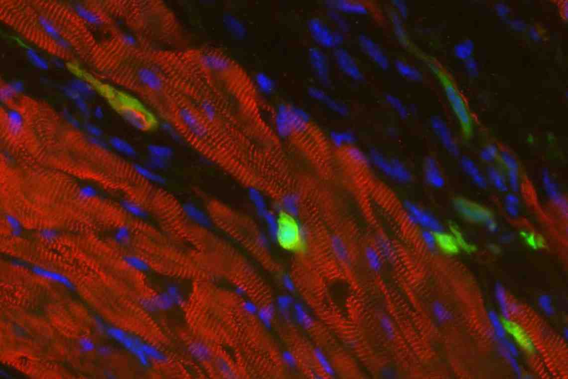 Индуцированные стволовые клетки