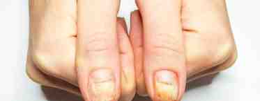 Сигналы тела: причины проблем кожи, ногтей, суставов
