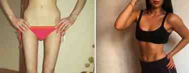 Анорексия: похудение, которое вышло из под контроля