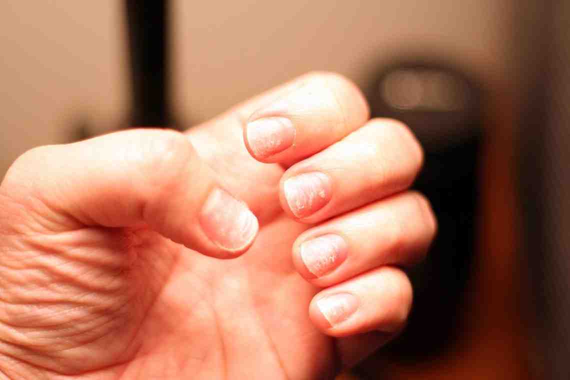 7 неочевидных причин, почему слоятся ногти