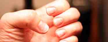 7 неочевидных причин, почему слоятся ногти