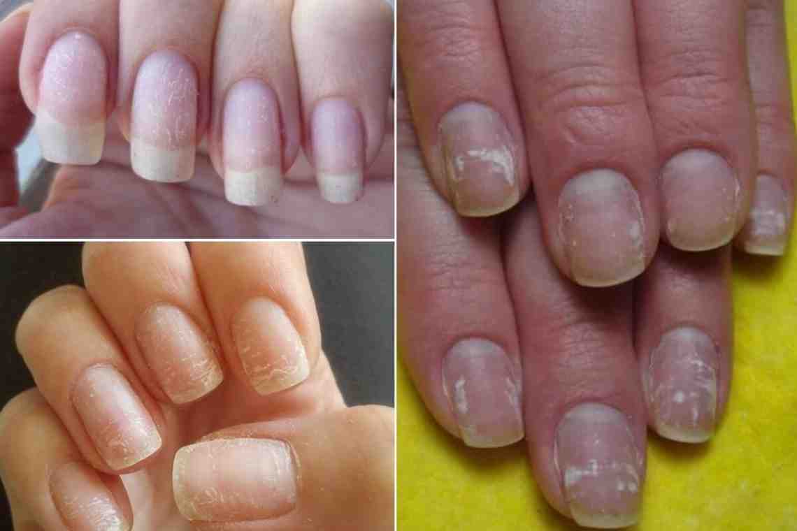 Как восстановить ногти после снятия гель-лака?