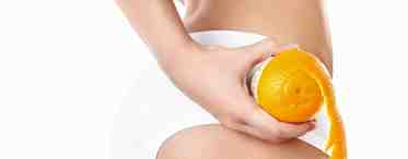 Целлюлит: о профилактике и комплексном лечении «апельсиновой корки»