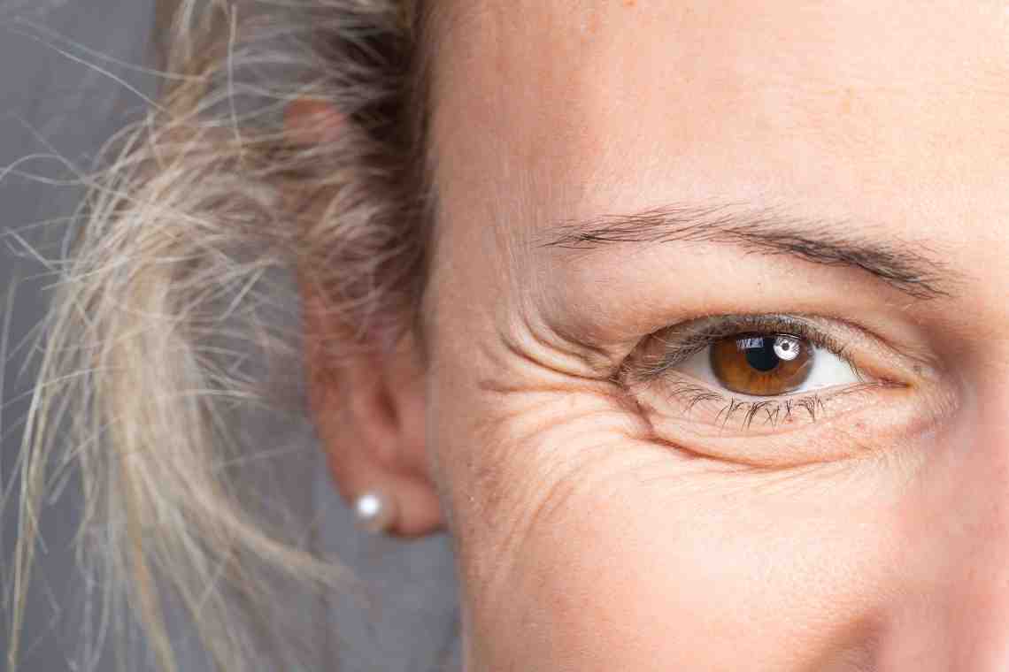 Ошибки, из-за которых возникают морщины на коже около глаз