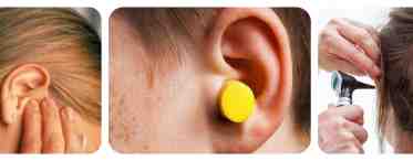 Как почистить уши перекисью водорода?