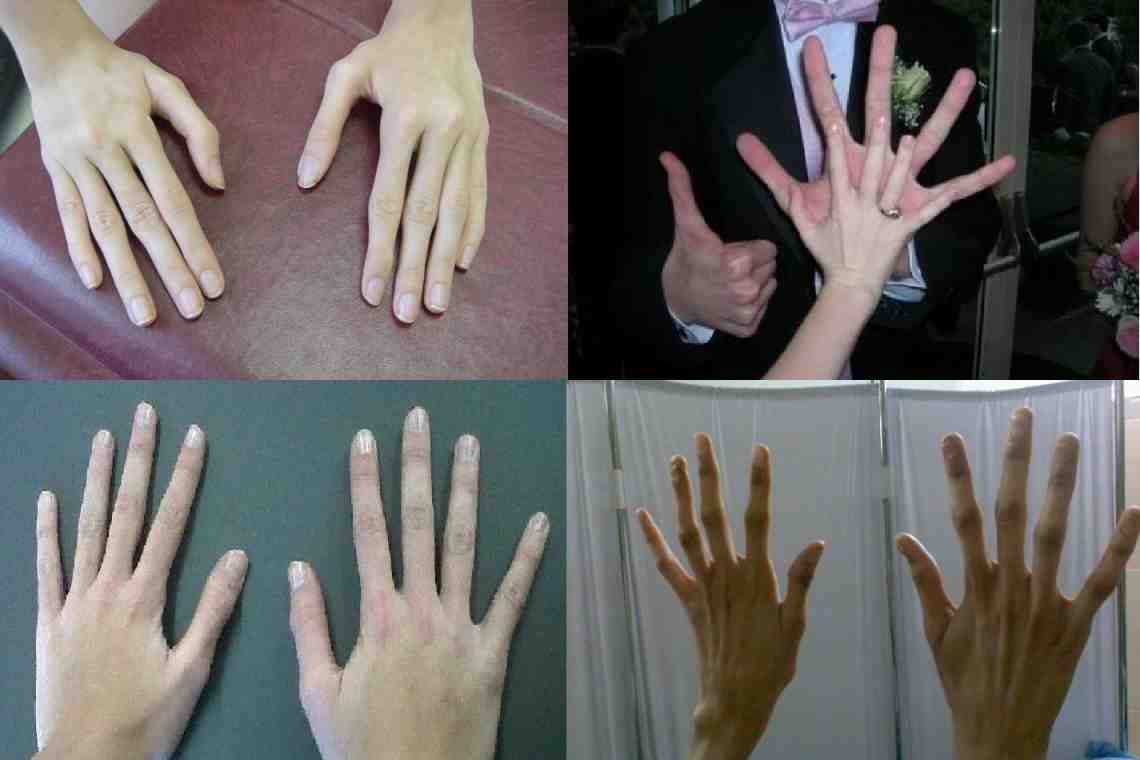Как сделать руки тоньше