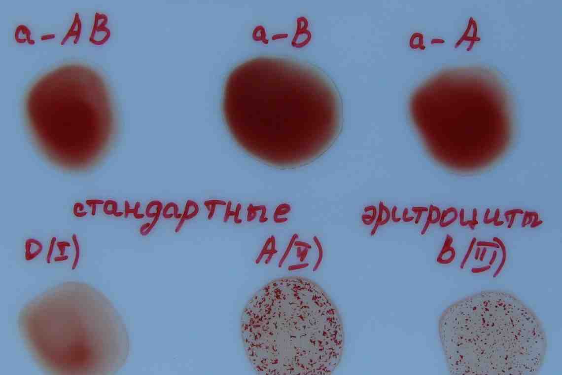 Система АВ0 и наследование группы крови у человека