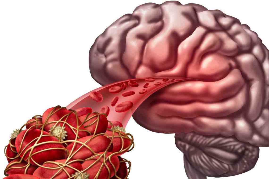 Здоровые сосуды головного мозга - профилактика атеросклероза