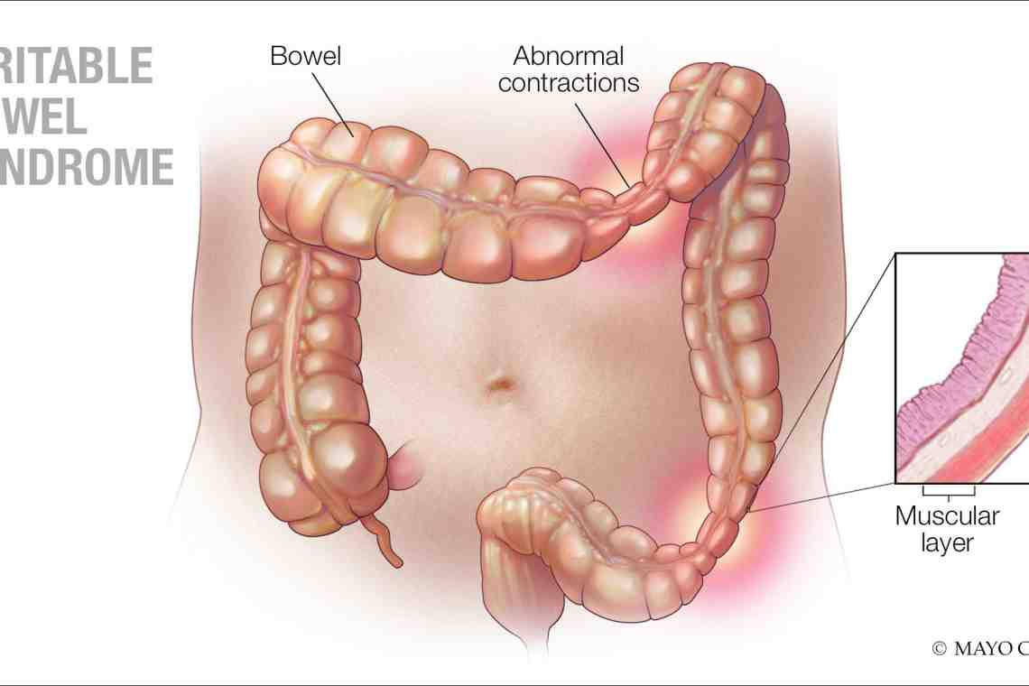 Опущение кишечника: причины, диагностика, симптомы и лечение