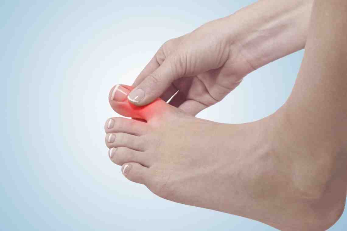 Онемение стоп и пальцев ног: причины и методы лечения