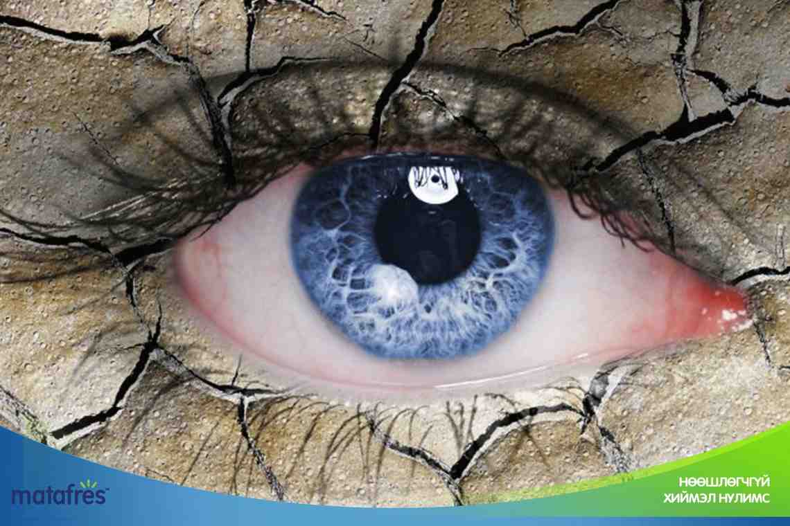 Синдром сухого глаза: причины, симптомы и способы лечения