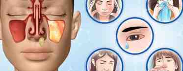 Воспаление слизистой оболочки носа: причины, симптомы и лечение