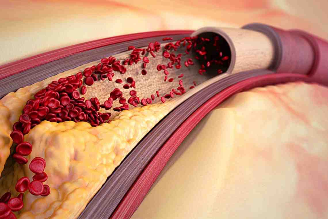 Как расслабить стенки артерий: блокаторы кальциевых каналов