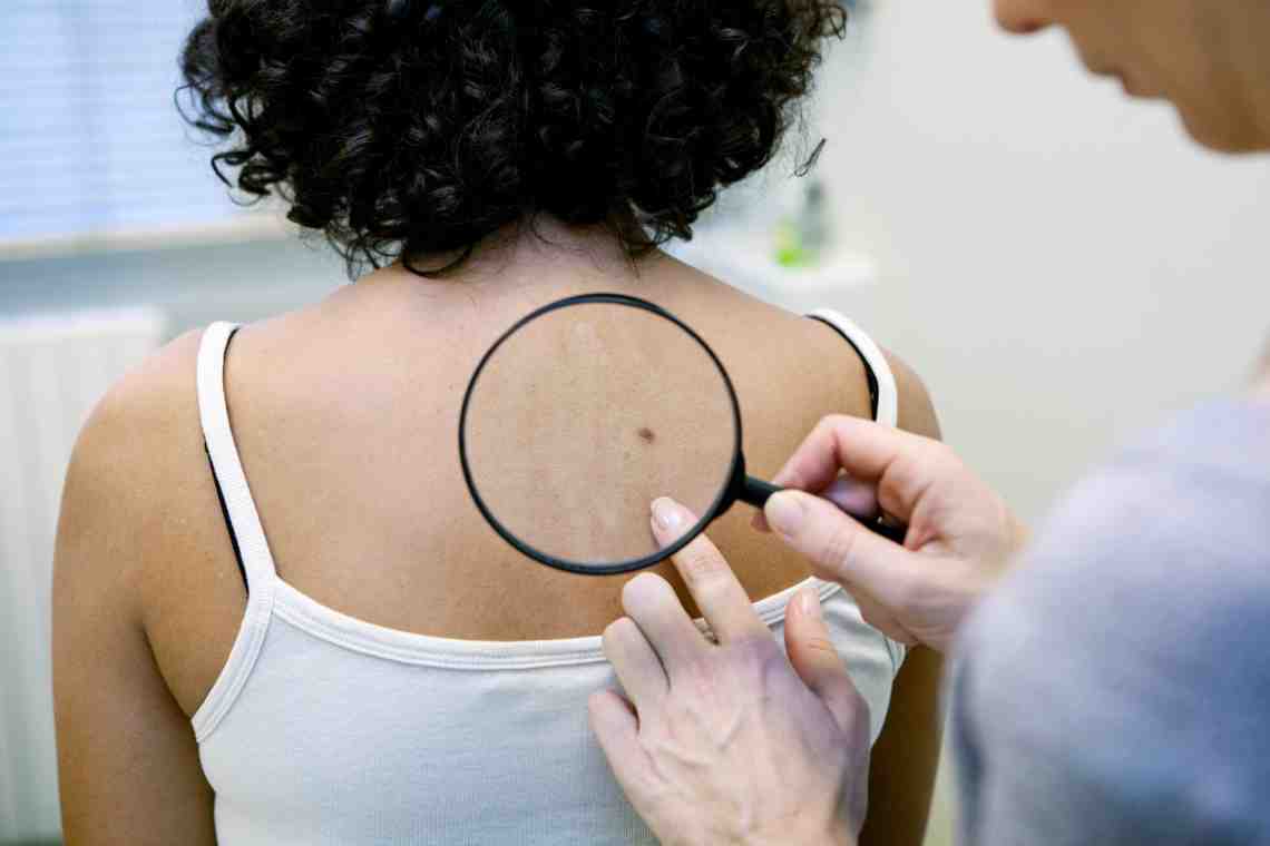 Самые распространенные заболевания кожи: особенности и возможные причины