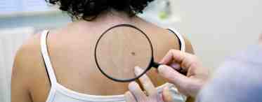 Самые распространенные заболевания кожи: особенности и возможные причины