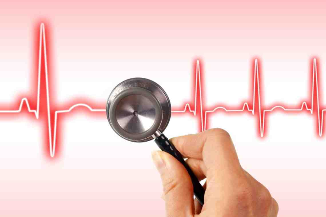 Желудочковая аритмия сердца: симптомы и лечение