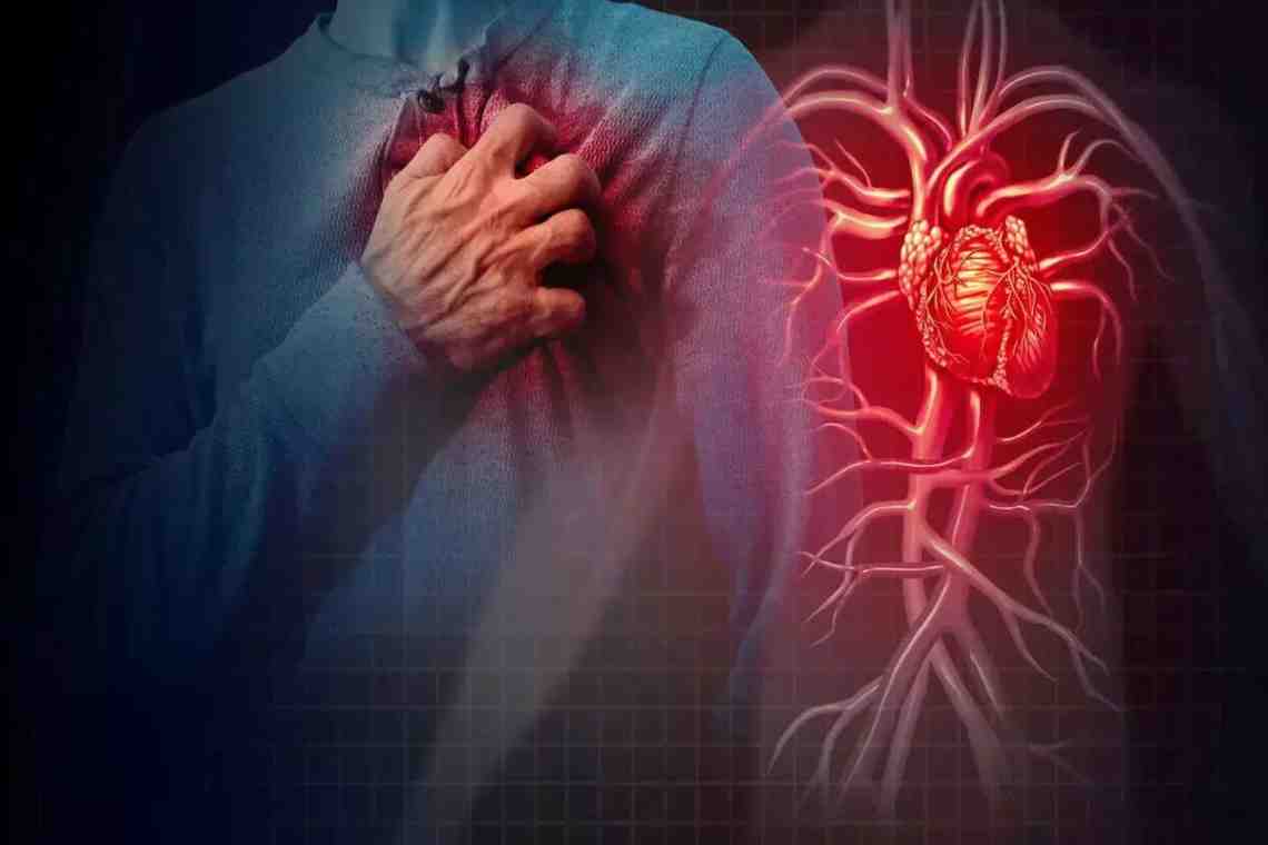 Боли при инфаркте: симптомы, диагностика, методы лечения