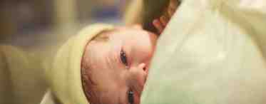Поражение ЦНС у новорожденных: причины, симптомы, методы лечения, последствия