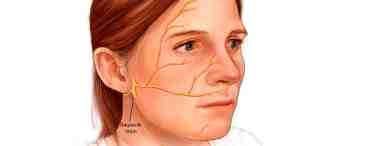 Нерв лицевой: причины поражения, симптомы и лечение