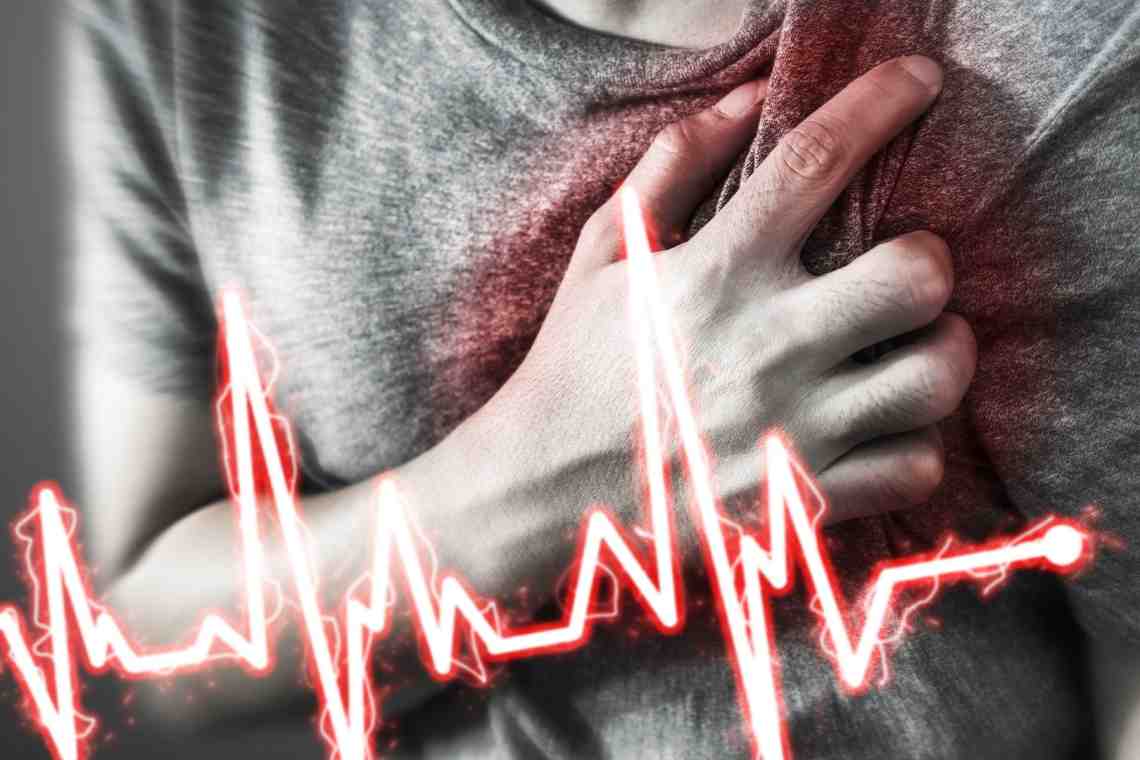 Как узнать инфаркт миокарда симптомы и признаки.