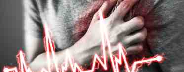 Как узнать инфаркт миокарда симптомы и признаки.