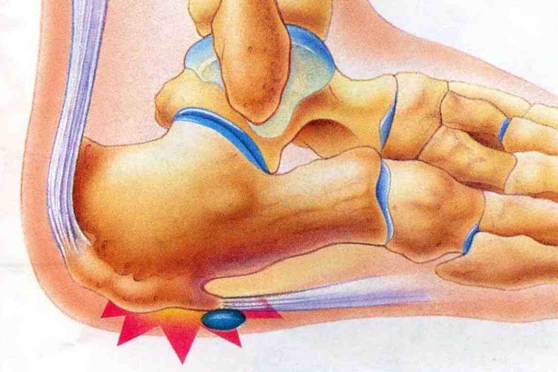 Легкое и тяжелое растяжение мышц ног 2 рецепта народной медицины