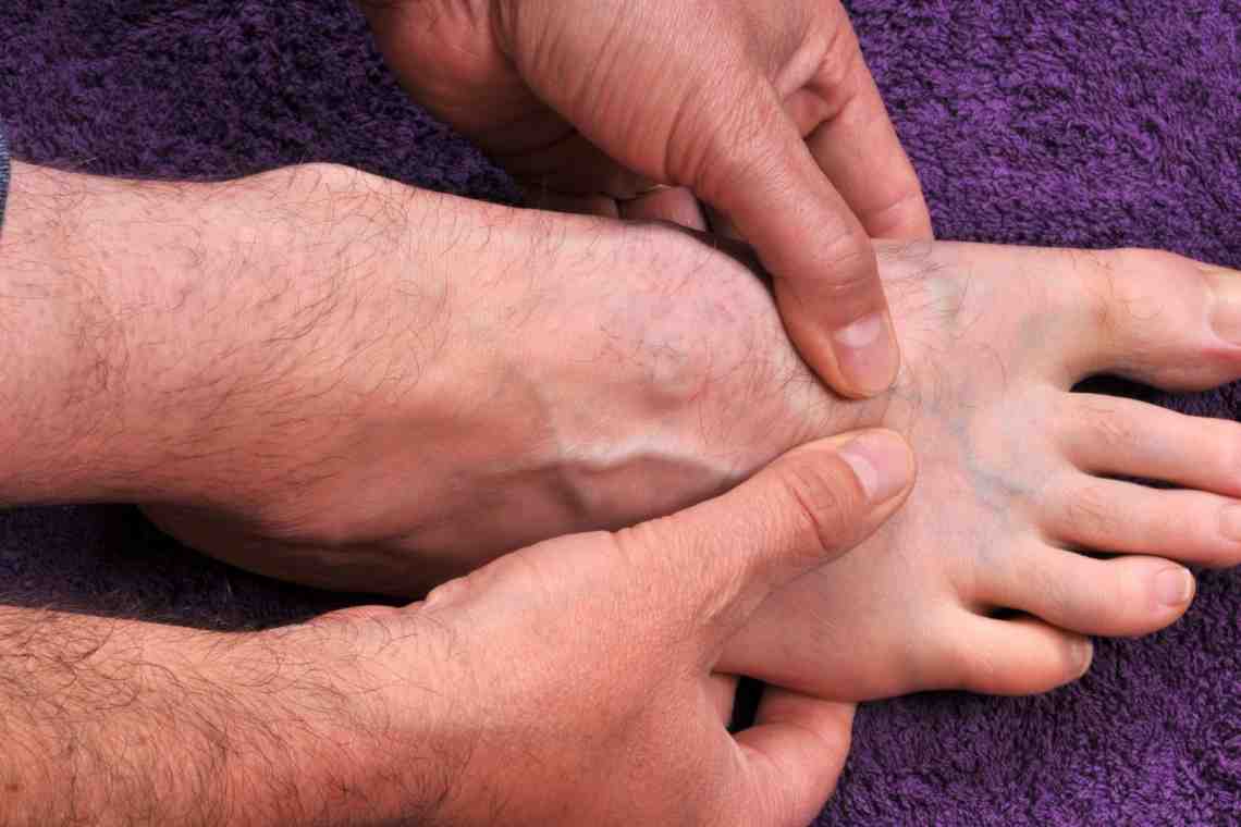 Ломота в ногах: возможные причины, способы и особенности лечения