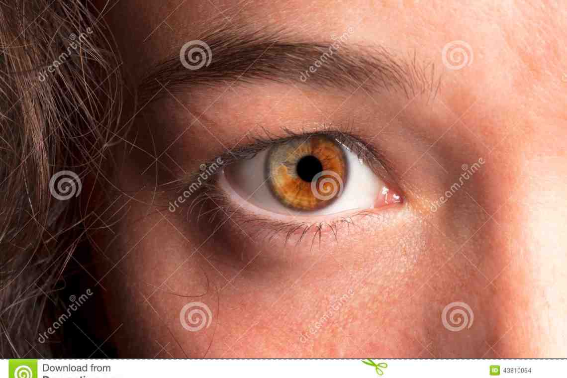 Загадочная патология – гетерохромия глаз