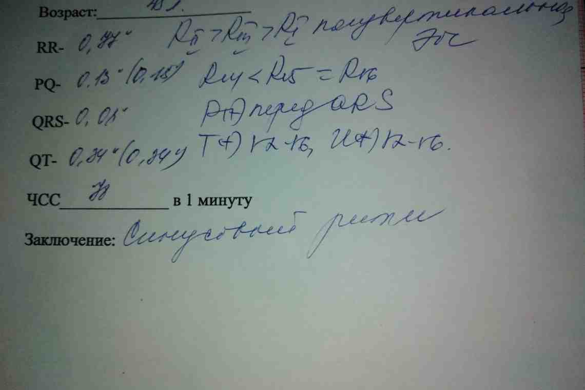 Блокада левой ножки пучка Гиса - что это?