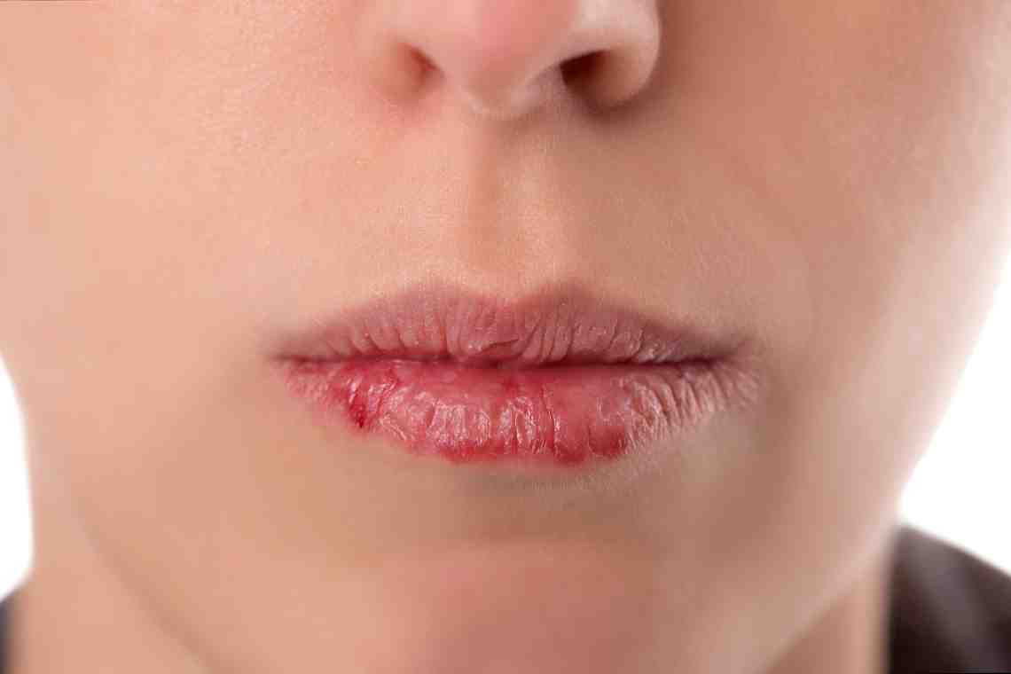 Горечь на губах: признак какого заболевания, диагностика и лечение