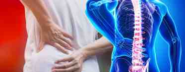 Боли в спине: причины, диагностика и методы лечения