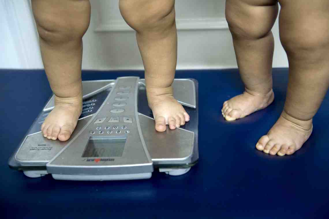 Ожирение у ребенка. Что делать?