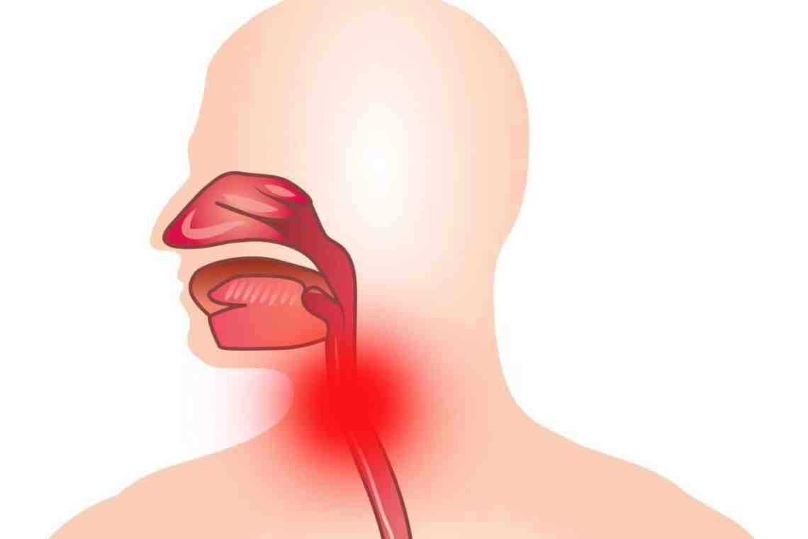 Болит трахея при глотании: причины и лечение