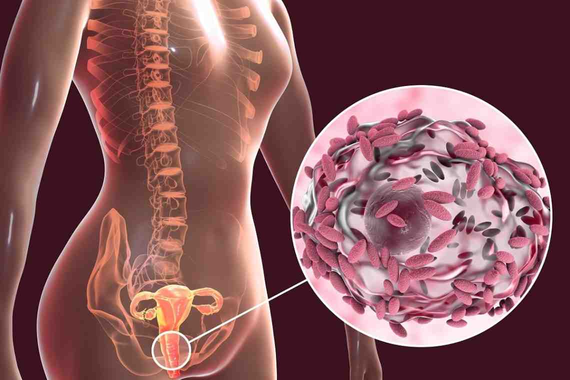 Вагинальный дисбактериоз: причины, симптомы и методы лечения