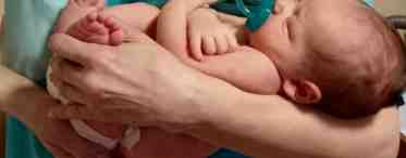 Гипертонус мышц у новорожденных детей