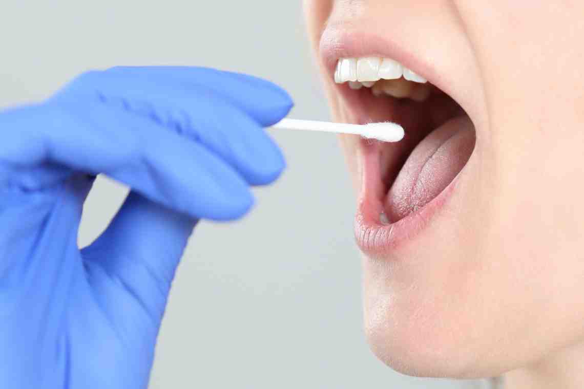 Вязкая слюна во рту: причины и способы лечения