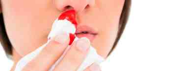 Кровотечение из носа: причины и лечение