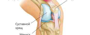 Разрывы связок коленного сустава