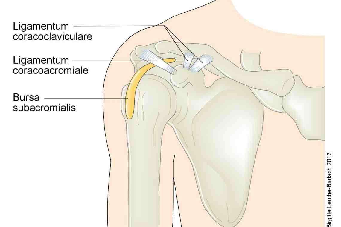 Акромиально ключичная мышца. Связки акромиально-ключичного сустава. Ligamentum coracoacromiale. Ligamentum coracoclaviculare. Акромиальный конец.
