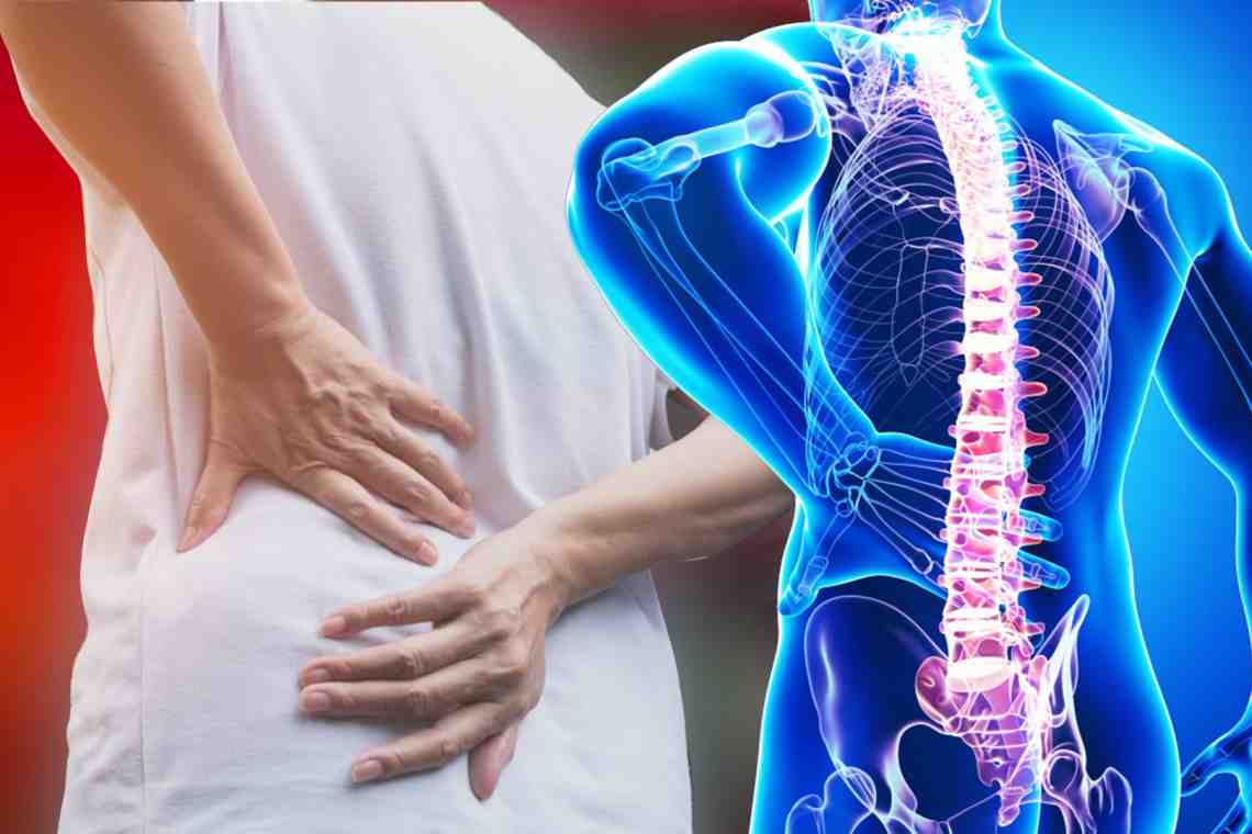 Осложнения остеохондроза: причины, симптомы и последствия