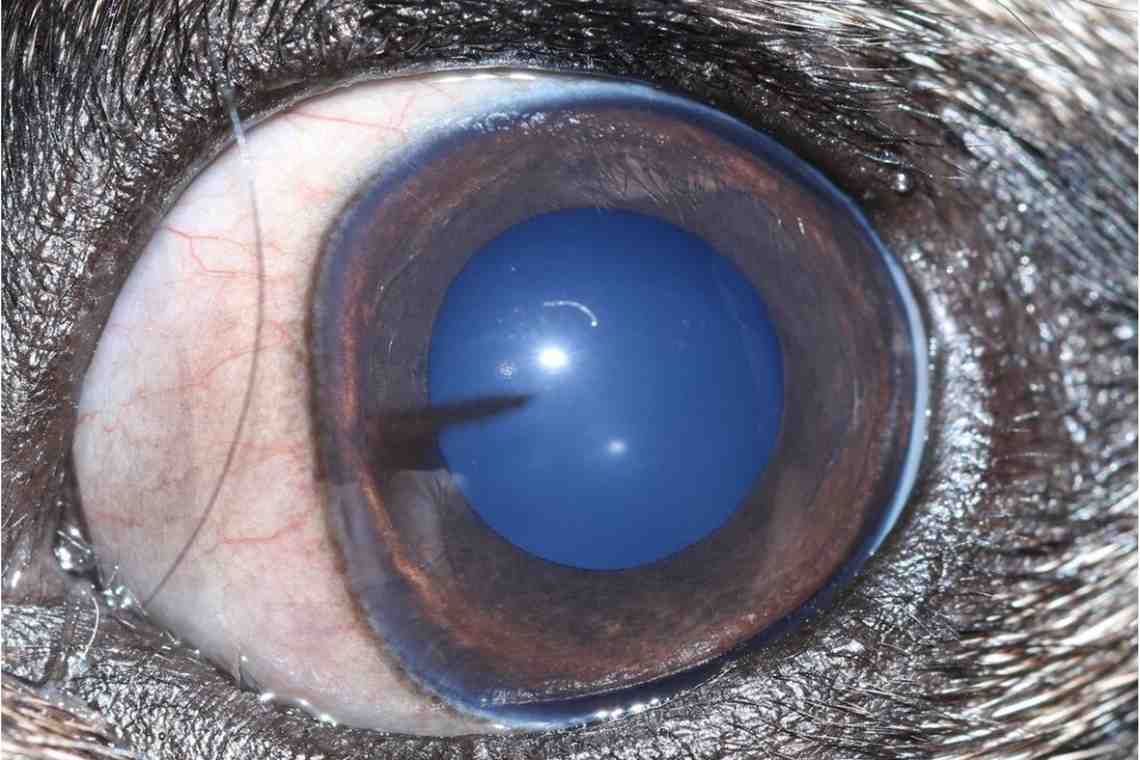 Кератит глаза: симптомы и лечение