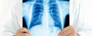 Милиарный туберкулез легких: формы, диагностика, симптомы, лечение