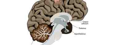 Опухоль головного мозга: симптомы, стадии, лечение, операция