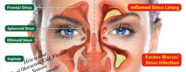 Атопическая бронхиальная астма: симптомы и лечение