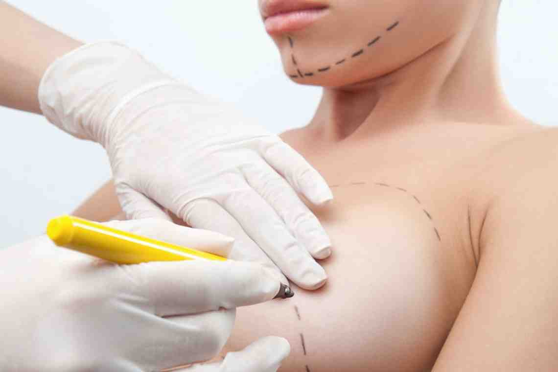 Удаление груди: показания, подготовка к операции, осложнения