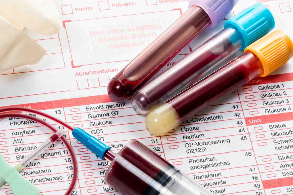 Биохимический анализ крови: расшифровка у взрослых