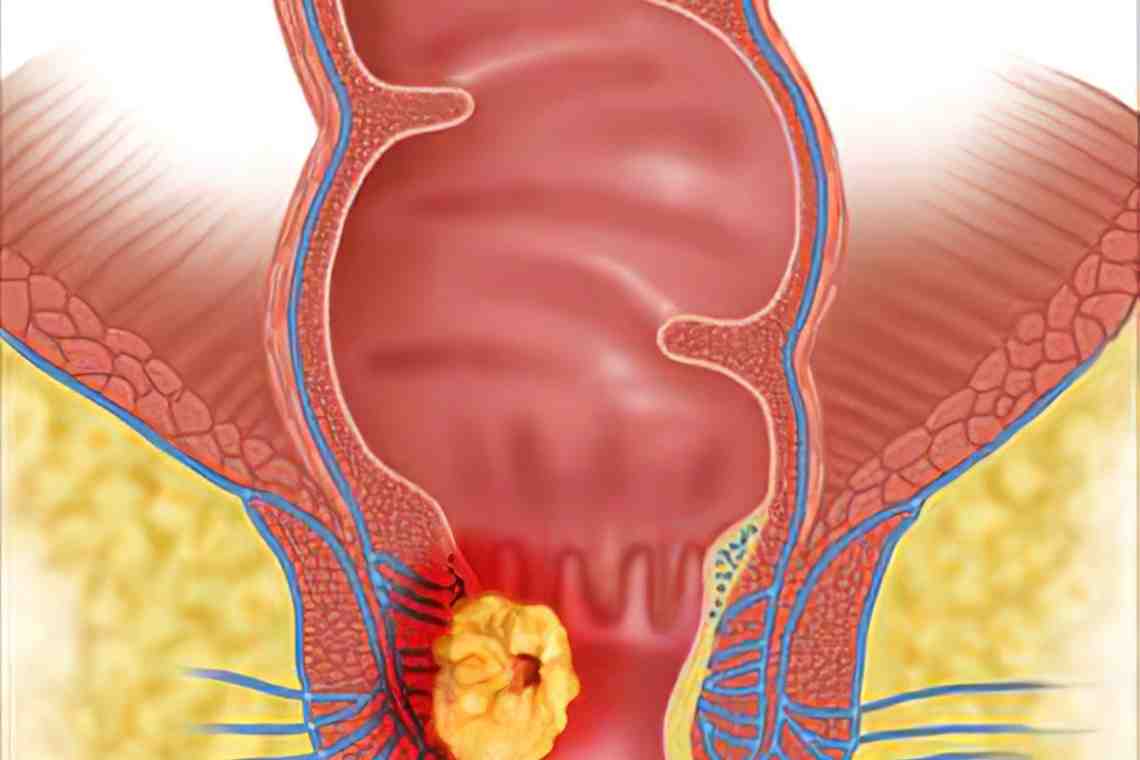 Анатомия прямой кишки и заднего прохода у мужчин фото
